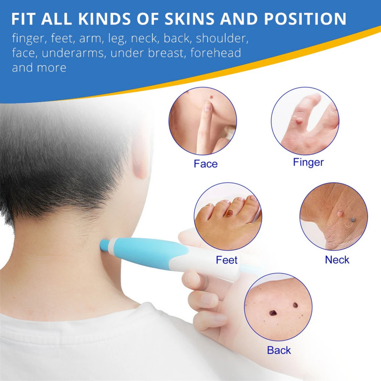 TagClear™ Kit - Get Rid of Skin Tags At-Home, Fast!